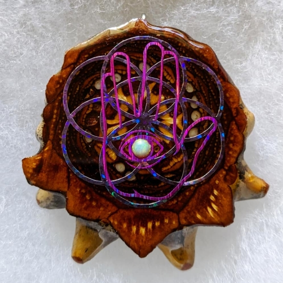 Pineal pinecone - Picture 11 of 13